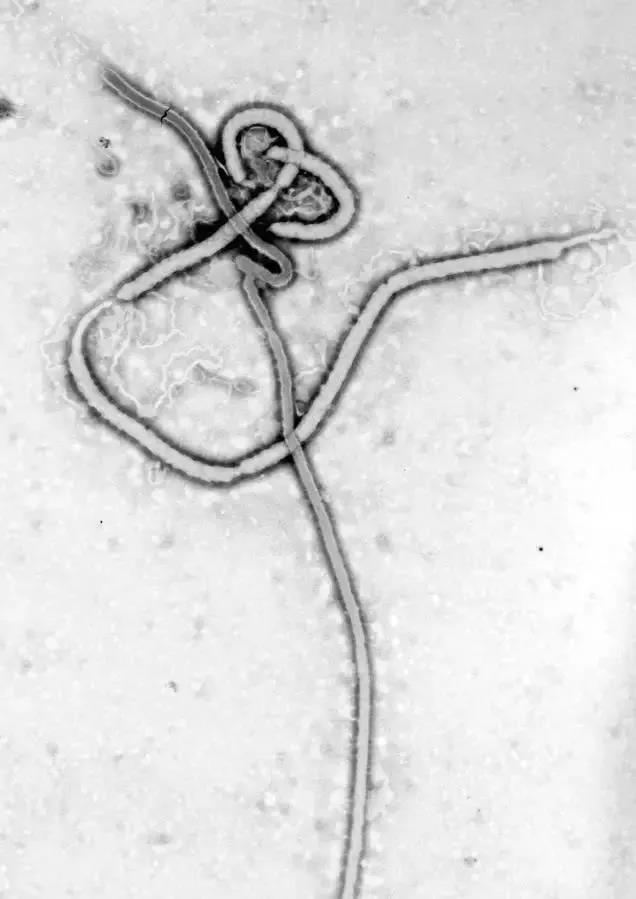 全球首款埃博拉病毒疫苗有望近期获批！