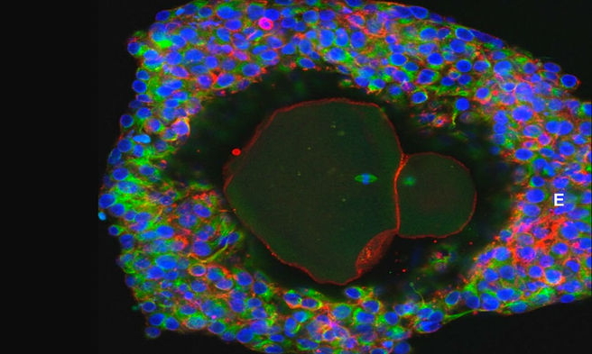 完全体外培育的卵细胞 能否解决不孕难题