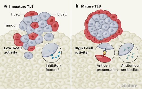 3篇Nature共同聚焦B细胞在抗癌免疫治疗中的作用