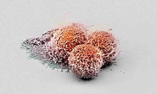 Nature：全新的肿瘤抑制蛋白 可阻止癌细胞在肝脏组织中扩散